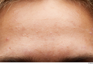 HD Face Skin Nathaniel face forehead skin pores skin texture…